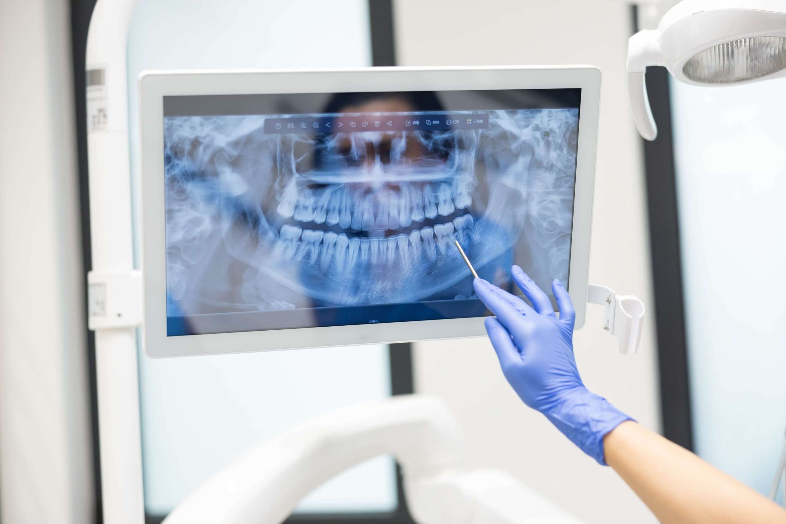 mouth xray