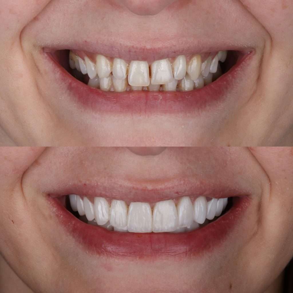 cosmetic dentistry catalina az