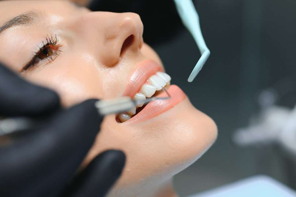 teeth cleaning casa adobes az