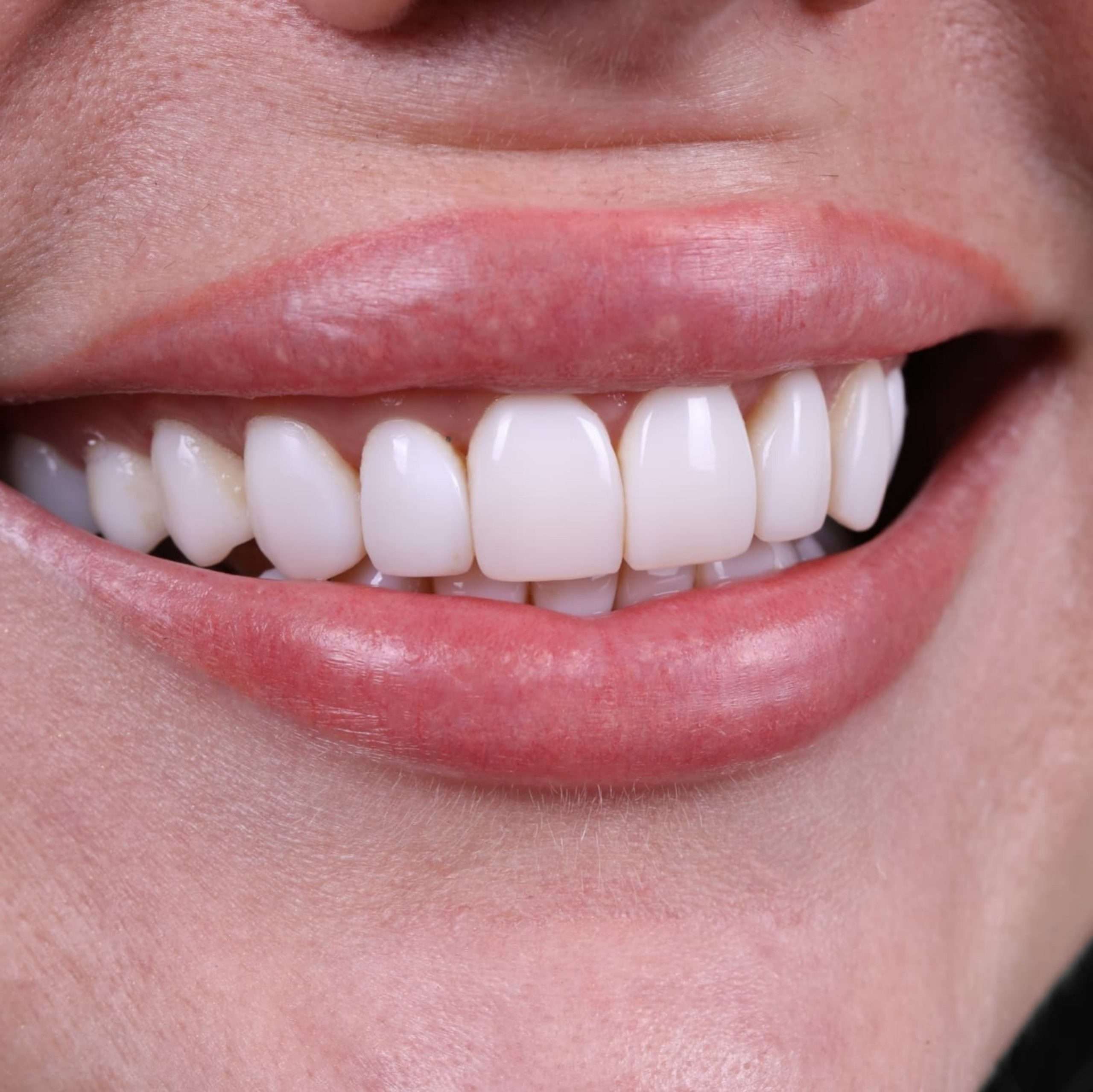 cosmetic dentistry marana az