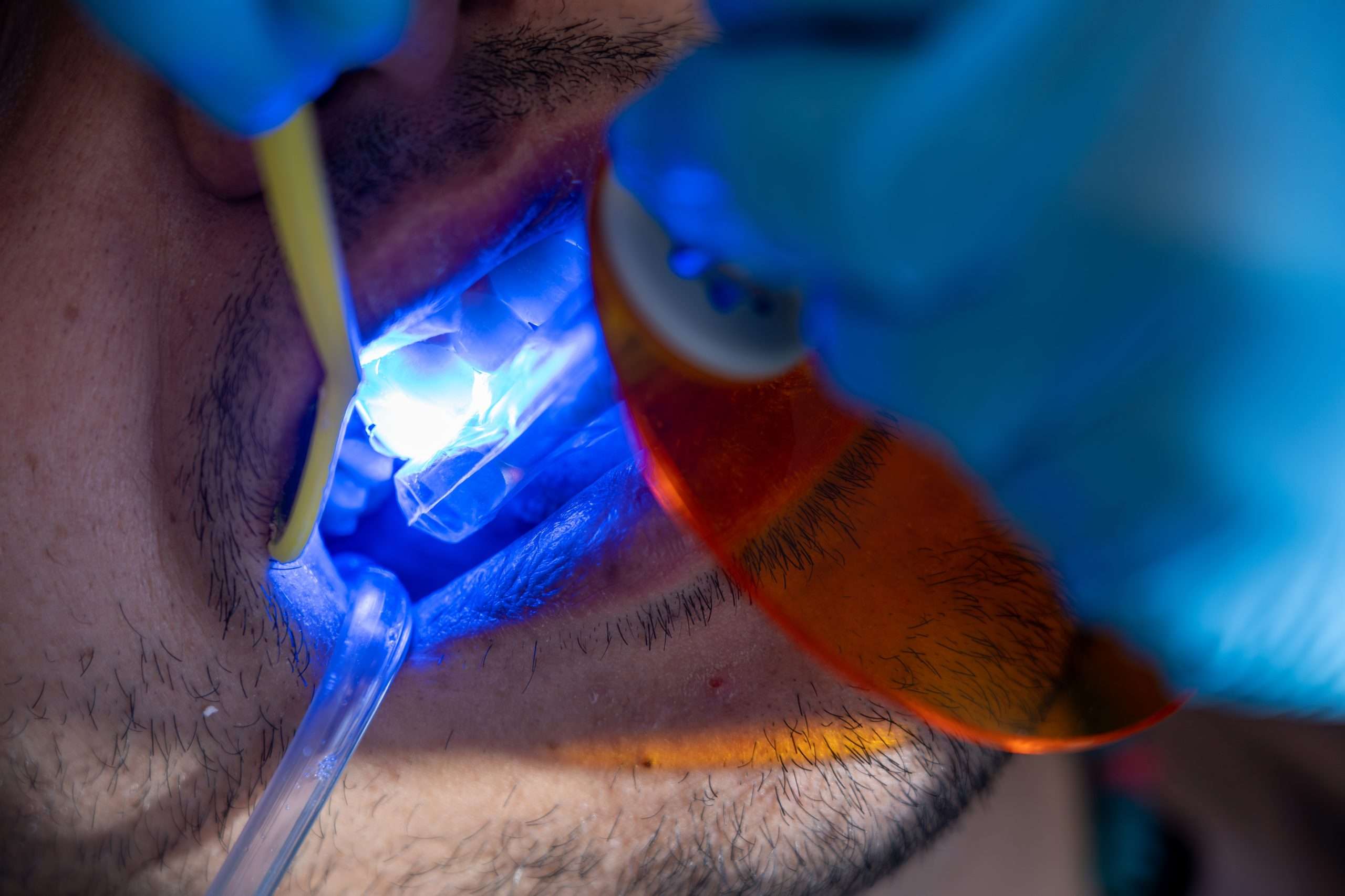 restorative dentistry marana az