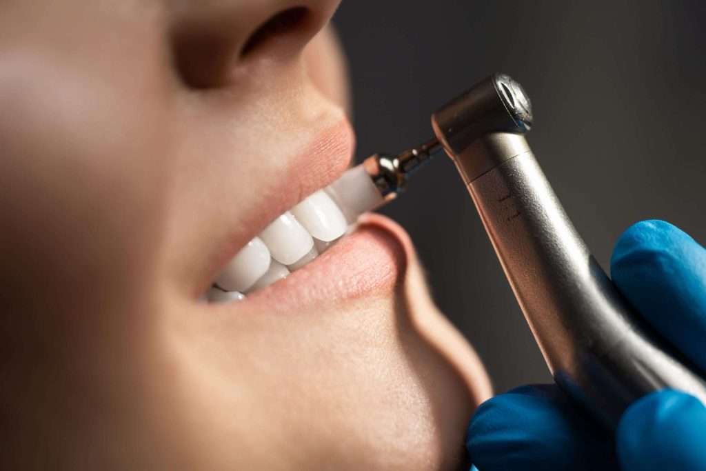 teeth cleaning marana az