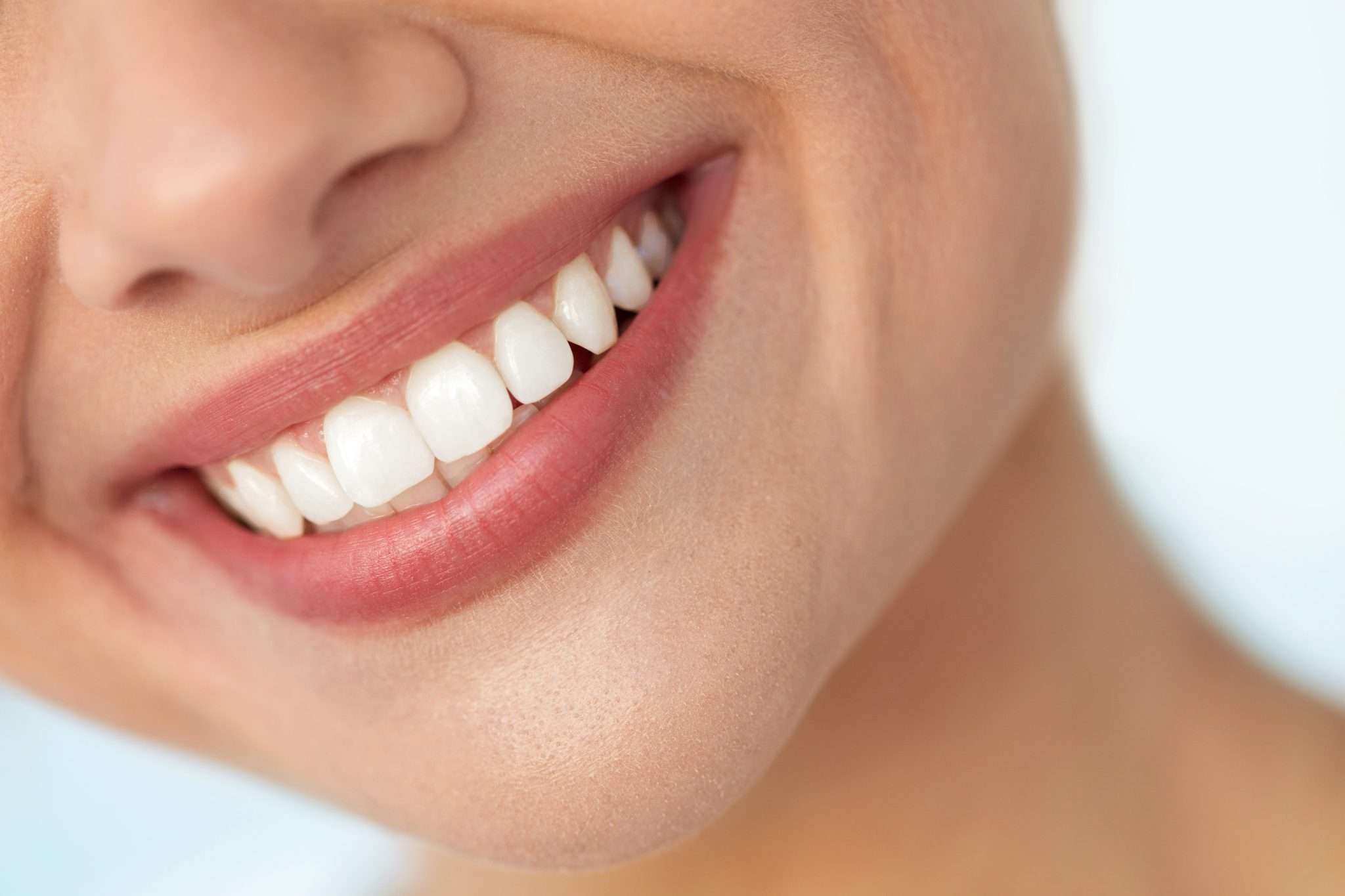 Close-up of a full, bright smile representing All-on-4 dental implants